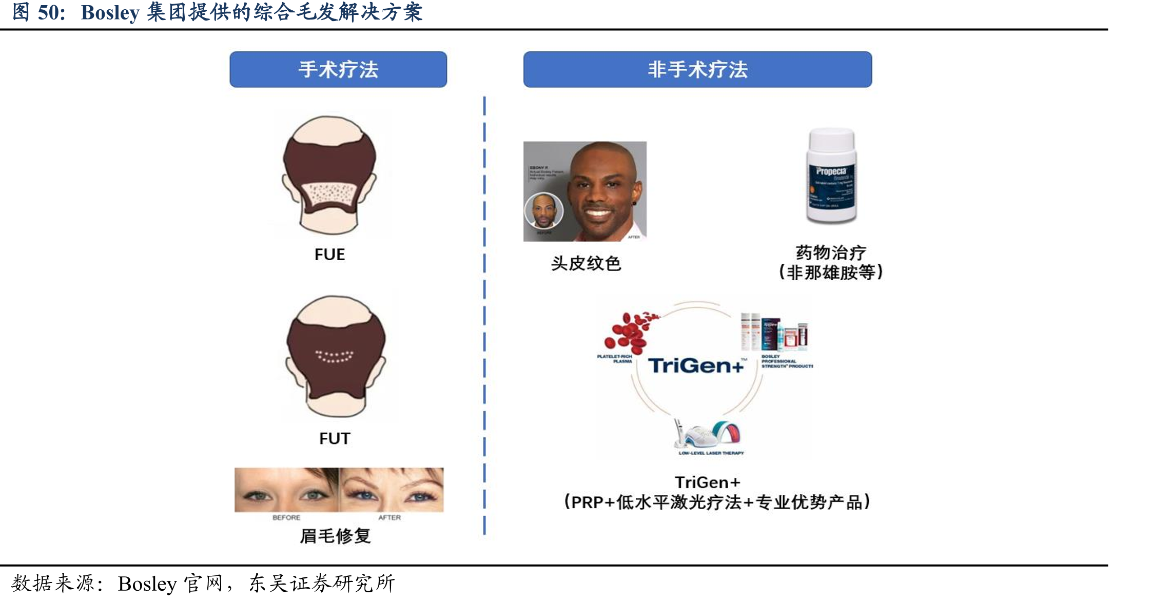 Bosley集团提供的综合毛发解决方案