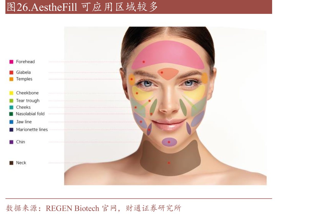 AestheFill可应用区域较多