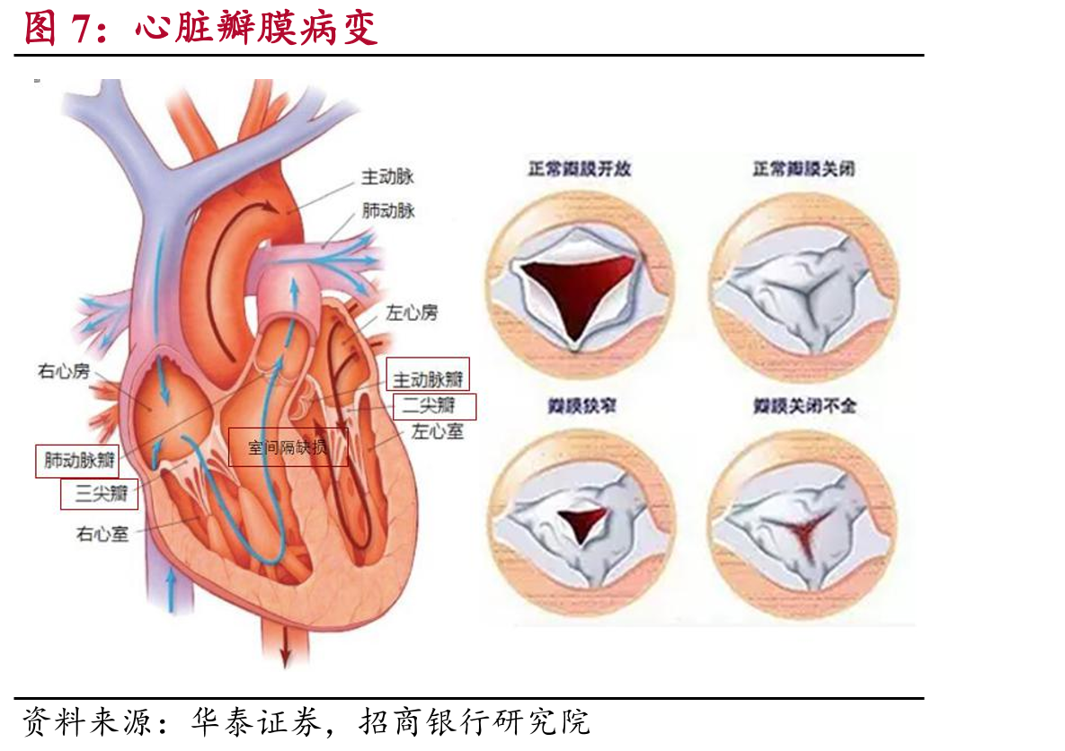医疗器械行业细分领域市场增速（2018）_第5页
