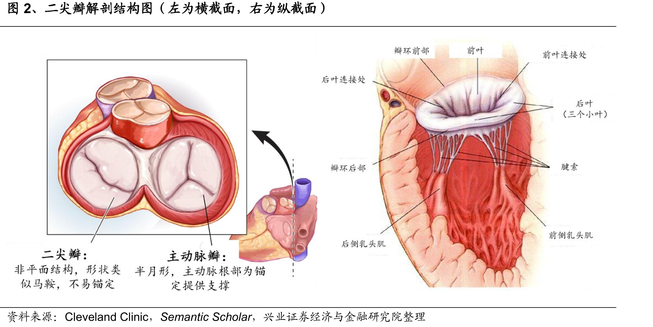 图2、二尖瓣解剖结构图（左为横截面，右为纵截面）